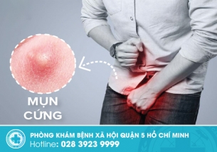 Dương vật nổi cục cứng có phải bệnh xã hội? Đọc ngay để biết rõ