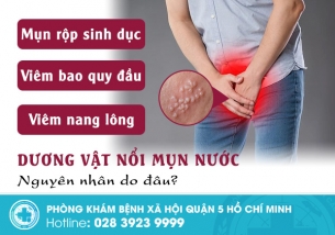 Nam giới hoang mang khi dương vật nổi mụn nước – Bác sĩ nói gì?