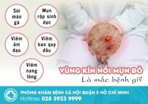 Giải mã tình trạng vùng kín nổi mụn đỏ và cách xử lý an toàn