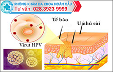 Hỗ trợ điều trị HPV ở nam giới bằng phương pháp nào hiệu quả?