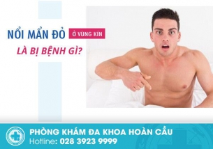 Cảnh giác với những căn bệnh xã hội làm nổi mẩn đỏ ở vùng kín