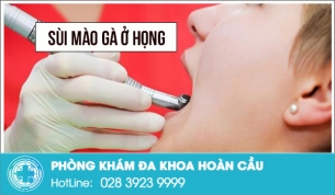 Sùi mào gà ở họng có dễ mắc phải?