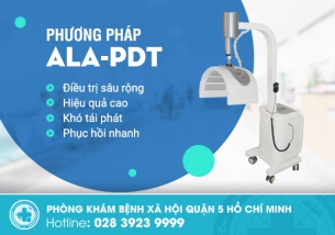 Tìm hiểu điều trị sùi mào gà bằng phương pháp ALA PDT