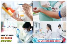 Xét nghiệm HPV có tốn kém không và địa chỉ nào hỗ trợ xét nghiệm HPV an toàn, chính xác tại TP.HCM?