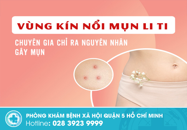 Chuyên gia chỉ ra nguyên nhân thật sự khiến vùng kín nổi mụn li ti